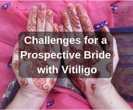 Prospective Vitiligo Leucoderma Bride challenges